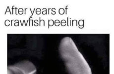 Don’t laugh! Check your fingers if u r a big Crawfish Eater!